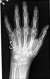 Hand X-ray